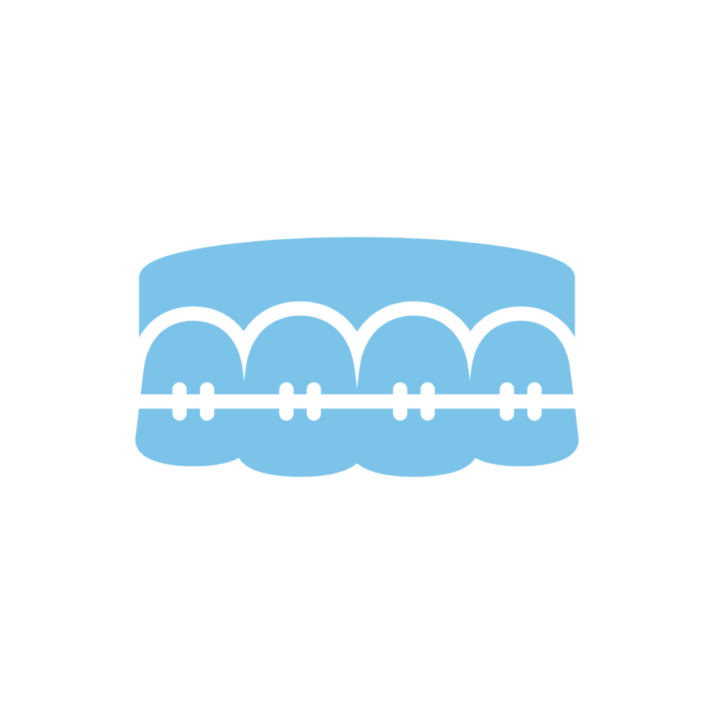 Dental Braces