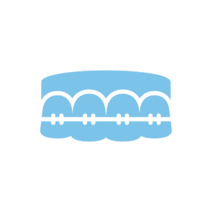 Dental Braces