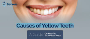 Causes of yellow teeth